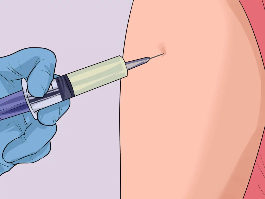 La vacunación es una buena opción para reducir significativamente las posibilidades de infección.